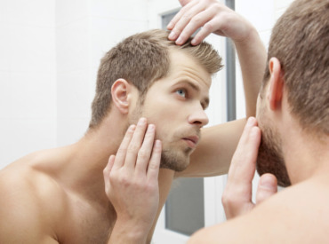 Hair loss in men: 5 styling tips for looking good